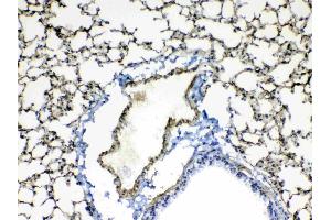 IHC analysis of Periostin using anti-Periostin antibody . (Periostin antibody  (AA 577-810))