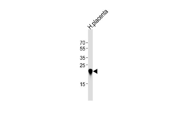 CSHL1 antibody  (C-Term)