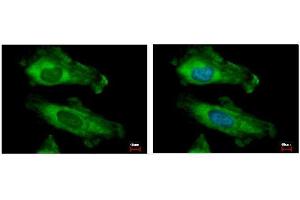 ICC/IF Image RPS10 antibody detects RPS10 protein at cytoplasm by immunofluorescent analysis.