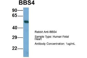 Host: Rabbit  Target Name: BBS4  Sample Tissue: Human Fetal Heart  Antibody Dilution: 1. (BBS4 antibody  (N-Term))