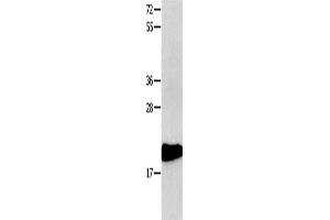Gel: 10+12 % SDS-PAGE, Lysate: 40 μg, Lane: 231 cells, Primary antibody: ABIN7190308(CMTM3 Antibody) at dilution 1/350, Secondary antibody: Goat anti rabbit IgG at 1/8000 dilution, Exposure time: 1 minute (CMTM3 antibody)