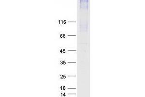 Solute Carrier Family 34 (Sodium Phosphate), Member 2 (SLC34A2) protein (Myc-DYKDDDDK Tag)