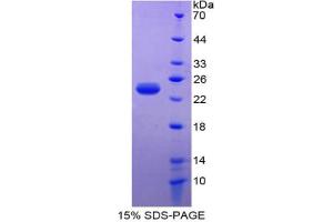 SDS-PAGE analysis of Mouse PARK7 Protein. (PARK7/DJ1 Protein)