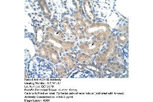 Rabbit Anti-ADH1B Antibody  Paraffin Embedded Tissue: Human Kidney Cellular Data: Epithelial cells of renal tubule Antibody Concentration: 4.