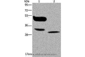 Western blot analysis of A375 cell and human lung cancer tissue, using MAGEA8 Polyclonal Antibody at dilution of 1:400 (MAGEA8 antibody)