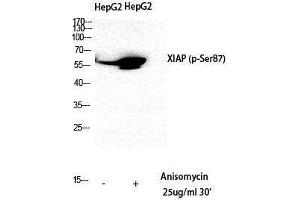 Western Blotting (WB) image for anti-X-Linked Inhibitor of Apoptosis (XIAP) (pSer87) antibody (ABIN3182566) (XIAP antibody  (pSer87))