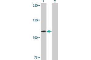 Western Blotting (WB) image for anti-Microtubule Associated Monoxygenase, Calponin and LIM Domain Containing 1 (MICAL1) (AA 1-981) antibody (ABIN528693)