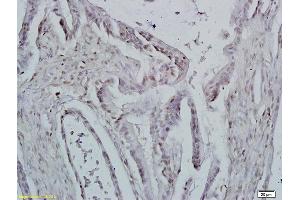 Formalin-fixed and paraffin embedded mouse lymphoma tissue labeled with Anti-ID1 Polyclonal Antibody, Unconjugated (ABIN700330) at 1:200 followed by conjugation to the secondary antibody and DAB staining (ID1 antibody  (AA 51-155))