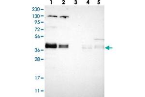 Western blot analysis of Lane 1: RT-4, Lane 2: U-251 MG, Lane 3: Human Plasma, Lane 4: Liver, Lane 5: Tonsil with ZFPL1 polyclonal antibody  at 1:250-1:500 dilution.