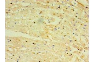Immunohistochemistry of paraffin-embedded human heart tissue using ABIN7151238 at dilution of 1:100 (TRIM11 antibody  (AA 267-468))