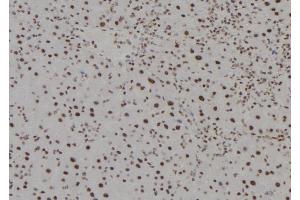 ABIN6279494 at 1/100 staining Mouse liver tissue by IHC-P. (HOXC13 antibody  (C-Term))