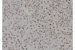 ABIN6279494 at 1/100 staining Mouse liver tissue by IHC-P. (HOXC13 antibody  (C-Term))