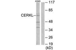 Western blot analysis of extracts from A549 cells, using CERKL Antibody. (CERKL antibody  (AA 341-390))