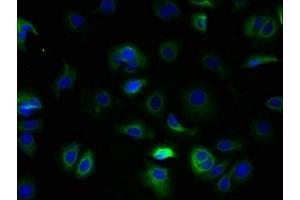Immunofluorescent analysis of MCF-7 cells using ABIN7171879 at dilution of 1:100 and Alexa Fluor 488-congugated AffiniPure Goat Anti-Rabbit IgG(H+L) (Tetraspanin 5 antibody  (AA 114-232))