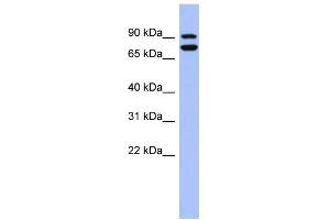 WB Suggested Anti-SOX6 Antibody Titration:  0.