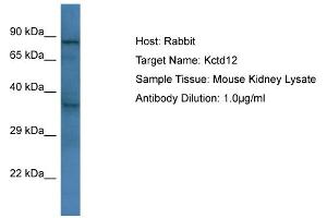 Host: Rabbit Target Name: Kctd12 Sample Type: Mouse Kidney lysates Antibody Dilution: 1. (KCTD12 antibody  (C-Term))