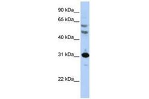 Image no. 1 for anti-Homeobox B5 (HOXB5) (AA 36-85) antibody (ABIN6741415)