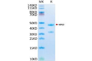 GDF15 Protein (AA 189-303) (Fc Tag)