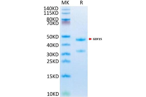 GDF15 Protein (AA 189-303) (Fc Tag)