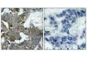 Immunohistochemistry (IHC) image for anti-Nuclear Factor of kappa Light Polypeptide Gene Enhancer in B-Cells Inhibitor, alpha (NFKBIA) (Ser32), (Ser36) antibody (ABIN7180025)