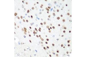 Immunohistochemistry of paraffin-embedded rat brain using CDK1 antibody. (CDK1 antibody  (AA 1-297))