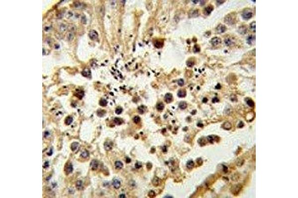 Histone H3.3 antibody  (Lys9)
