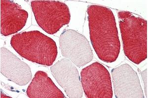 ABIN5539869 (5µg/ml) staining of paraffin embedded Human Skeletal Muscle. (MIA antibody  (Internal Region))