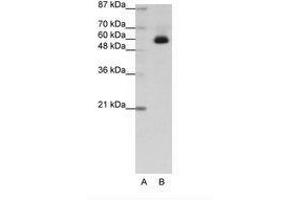 Image no. 1 for anti-Zinc Finger Protein 307 (ZKSCAN4) (C-Term) antibody (ABIN202741)