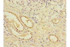 Immunohistochemistry of paraffin-embedded human kidney tissue using ABIN7163118 at dilution of 1:100 (Lipin 1 antibody  (AA 741-890))