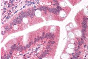 Human Small Intestine: Formalin-Fixed, Paraffin-Embedded (FFPE) (Embigin antibody  (C-Term))