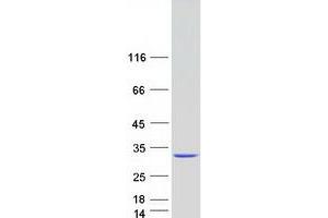 Validation with Western Blot