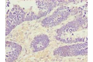 PADI3 antibody  (AA 1-664)