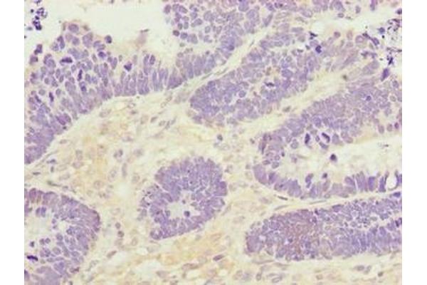 PADI3 antibody  (AA 1-664)