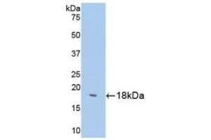 Detection of Recombinant SST, Human using Polyclonal Antibody to Somatostatin (SST) (Somatostatin antibody  (AA 1-116))