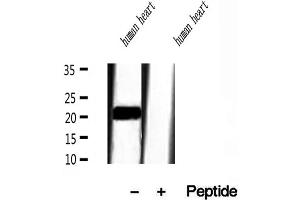 Western blot analysis of extracts of human heart tissue, using Transgelin 2 antibody. (TAGLN2 antibody  (Internal Region))