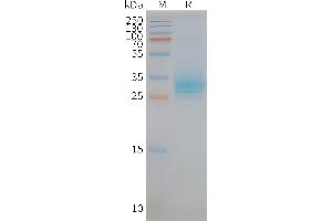SDS-PAGE (SDS) image for CD151 (CD151) protein (ABIN7491574)