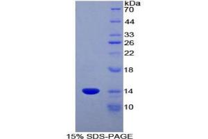 SDS-PAGE analysis of Rat CCL6 Protein. (MRP1 Protein)