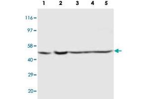 Western blot analysis of tissue and whole cell extracts with PSEN2 polyclonal antibody . (Presenilin 2 antibody  (Internal Region))