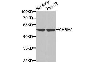 Western blot analysis of extracts of various cell lines, using CHRM2 antibody. (Muscarinic Acetylcholine Receptor M2 antibody  (AA 208-388))
