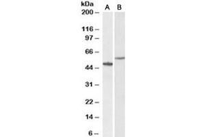 Western blot testing of human hippocampus [A] and HeLa [B] lysates with CD47 antibody at 0. (CD47 antibody)