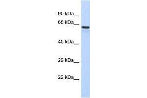 Host:  Rabbit  Target Name:  TBX3  Sample Type:  Fetal Liver lysates  Antibody Dilution:  1. (TBX3 antibody  (C-Term))