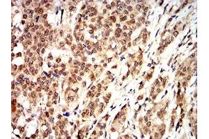 Immunohistochemistry (IHC) image for anti-Cyclin D1 (CCND1) (AA 167-295) antibody (ABIN5542302)