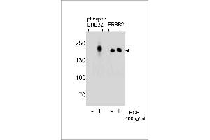Western blot analysis of extracts from A431 cells,untreated or treated with EGF,100 ng/mL,using phospho ERBB2  (left) or ERBB2 Antibody (right) (ErbB2/Her2 antibody  (pTyr1196))