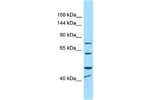 Western Blotting (WB) image for anti-Microcephalin 1 (MCPH1) (C-Term) antibody (ABIN2789648)