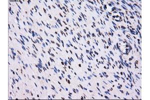 Immunohistochemical staining of paraffin-embedded Ovary tissue using anti-PPME1mouse monoclonal antibody.