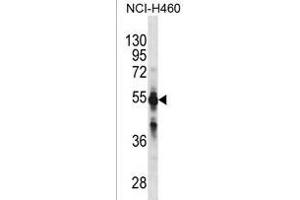 CYP2C9 Antibody (N-term)(Ascites) ABIN1882233 western blot analysis in NCI- cell line lysates (35 μg/lane). (CYP2C9 antibody  (N-Term))
