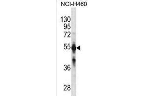 CYP2C9 Antikörper  (N-Term)