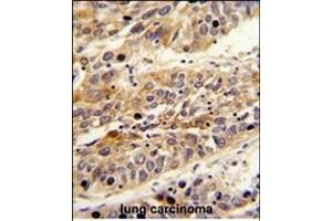 Immunohistochemistry (Paraffin-embedded Sections) (IHC (p)) image for anti-Leucine-Rich alpha-2 Glycoprotein 1 (LRG1) (AA 194-223) antibody (ABIN390660)