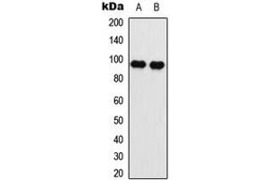 Western blot analysis of EEF2 (pT56) expression in SKOV3 (A), NIH3T3 (B) whole cell lysates. (EEF2 antibody  (N-Term, pSer56))