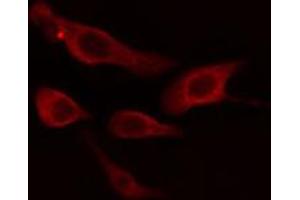 ABIN6274645 staining HT29 cells by IF/ICC. (CYP2B6 antibody  (Internal Region))